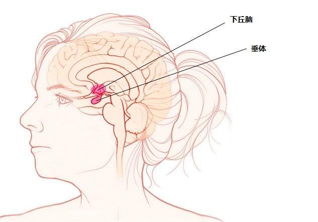 垂體瘤圖片