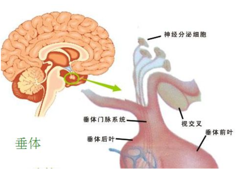 垂體瘤圖片